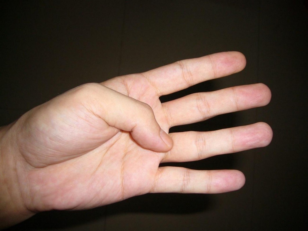 Hình 19: Bước 2: ngón cái đặt vào ngấn gốc ngón áp út