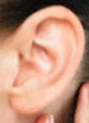 Tai có tì vết trên đỉnh quách — một thời kỳ thiếu thốn hoặc đau ốm