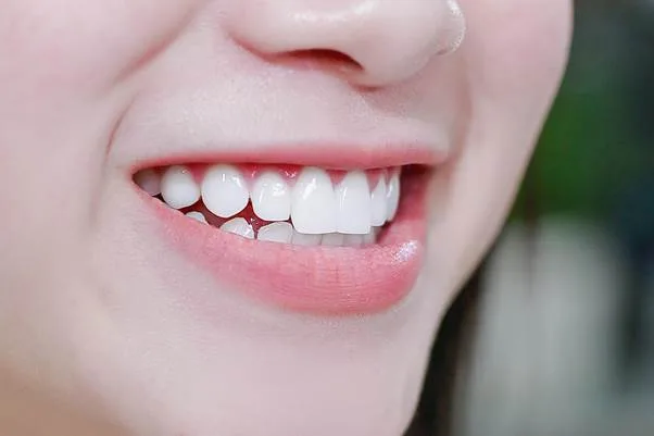 Tướng răng: răng trên chủ định mệnh gia đình, răng dưới chủ vận mệnh do mình tạo — nhân tướng liên hoa