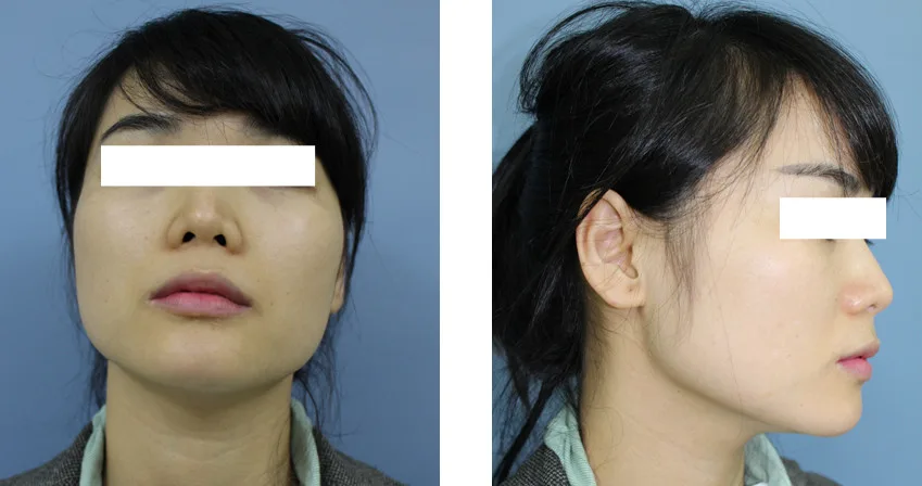 Tướng quai hàm: điểm tích tụ tiền bạc và phúc đức, xem hậu vận — nhân tướng học